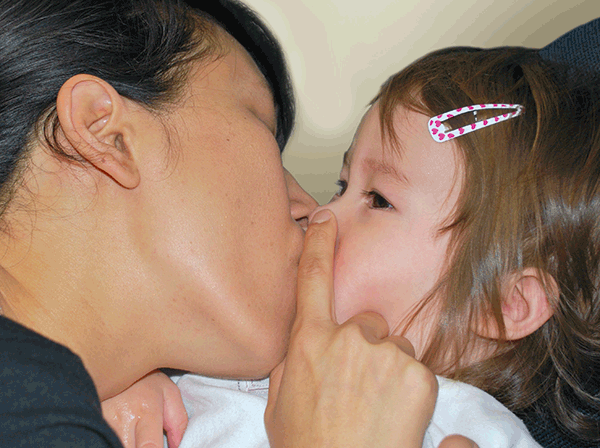 La tecnica del "bacio della madre" - Fonte: https://www.racgp.org.au/afp/2013/may/mothers-kiss